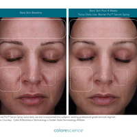 NEW! Barrier Pro Serum Spray