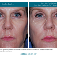 NEW! Barrier Pro Serum Spray