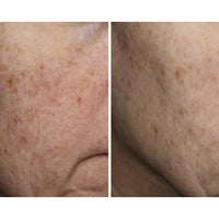 Ourself Complexion Brightening Serum