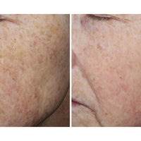 Ourself Complexion Brightening Serum