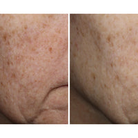 Ourself Complexion Brightening Serum