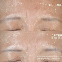 Ourself HA+ Replenishing Serum
