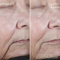 Ourself HA+ Replenishing Serum