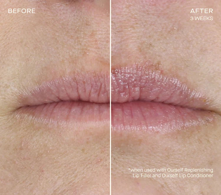 Replenishing Lip Filler PREORDER