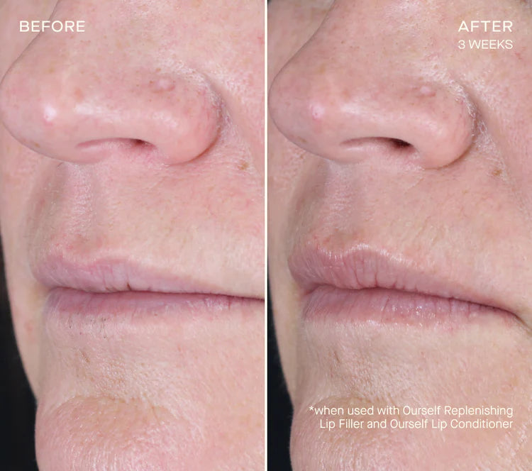 Replenishing Lip Filler PREORDER