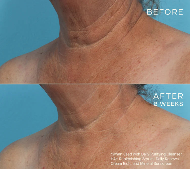 Ourself HA+ Replenishing Serum