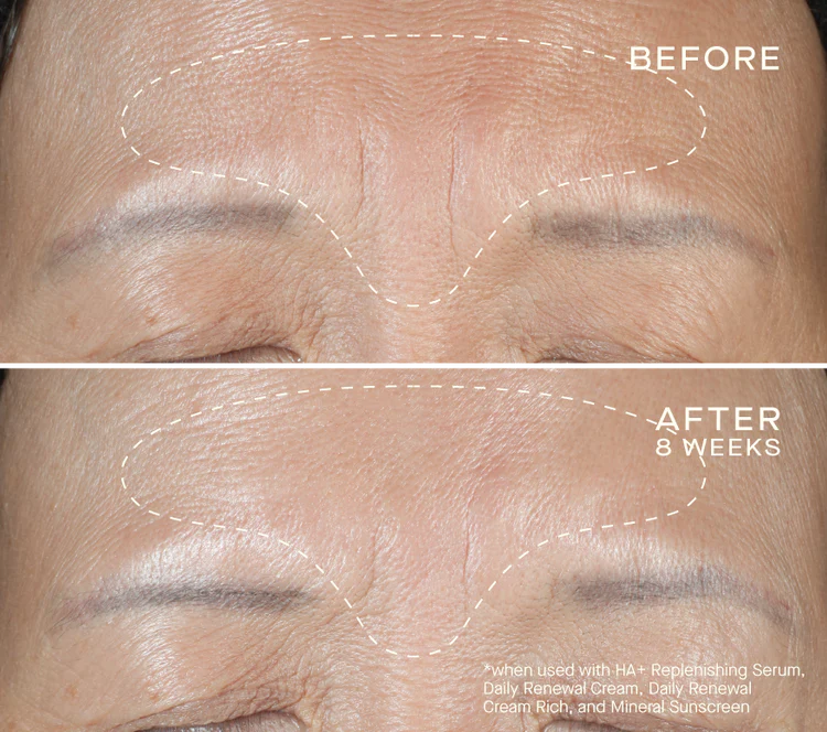 Ourself HA+ Replenishing Serum