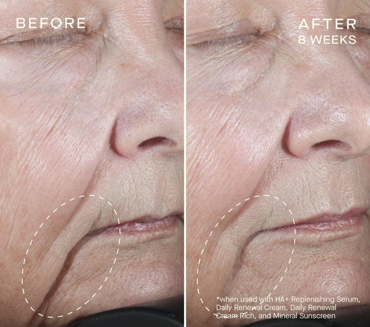 Ourself HA+ Replenishing Serum